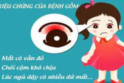 Trường mầm non Hoa Sen-Bài tuyên truyền phòng chống bệnh đau mắt đỏ